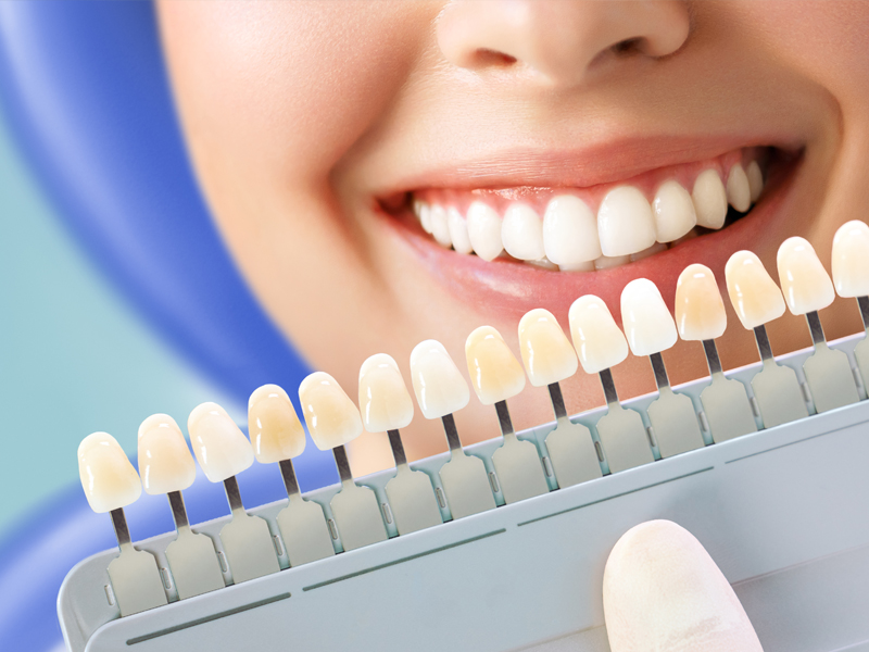 Diş Eti Tedavileri (Periodontoloji)